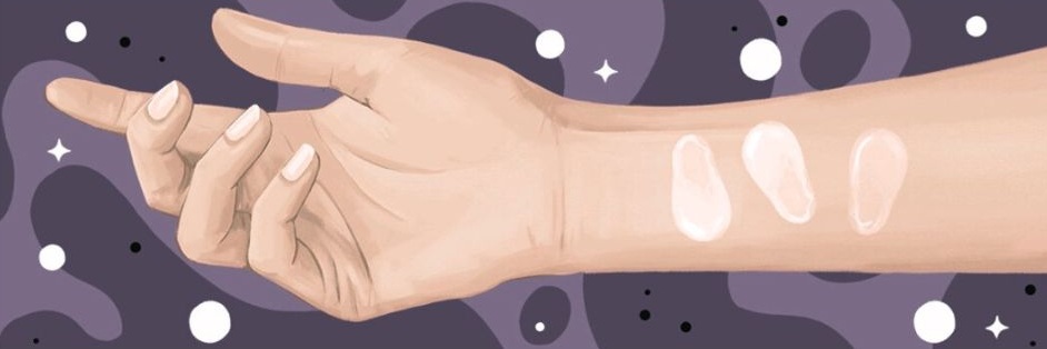 Ghid complet pentru testul de alergie la cosmetice