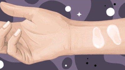 Ghid complet pentru testul de alergie la cosmetice