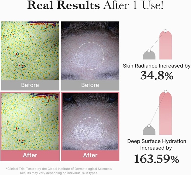 Aceasta este imaginea corespunzatoare acestui obiect