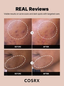 COSRX – The Alpha-Arbutin 2 Discoloration Care Serum – Ser cu 2 % alpha-arbutin pentru petele pigmentare - Img 15