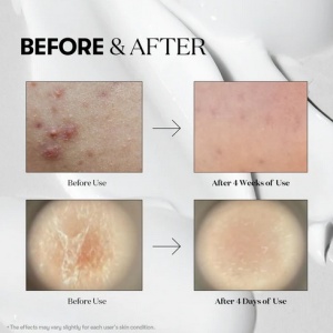 VT Cosmetics - Reedle Shot 700 - Ser booster facial cu microace Cica Reedle™ - Img 3