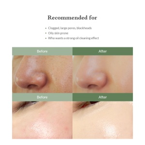 Dr. Althea – Premium Quick Step Sebum Cleanser – Solutie exfolianta pentru curățarea profundă a porilor și reducerea punctelor negre - Img 6