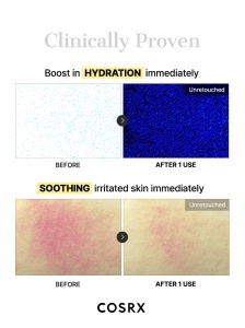 Advanced Snail Mucin Glass Glow Hydrogel Mask COSRX – mască hidrogel cu 25 % mucină de melc, 3 buc. - Img 14