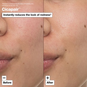 Dr.Jart+ - Cicapair Intensive Soothing Repair Cream - Cremă reparatoare intensivă calmantă - Img 3