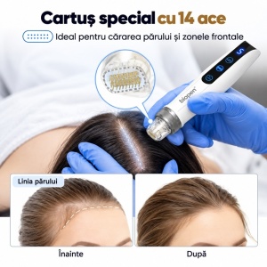 Bio Pen Q2 wireless 3-in-1 cu Microneedling, EMS si fototerapie LED - Img 9