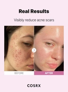 COSRX The Niacinamide 15 Serum – Ser cu 15 % niacinamida pentru controlul sebumului - Img 11