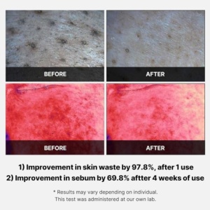 Medicube – Red Succinic Acid Peeling Pad – Dischete exfoliante pentru fata – 70 buc - Img 5