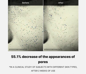 Medicube - Zero Pore One-day Cream - Cremă pentru pori dilatați cu acizi BHA - Img 5