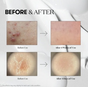 VT Cosmetics - Reedle Shot 300 - Ser booster facial cu microace Cica Reedle™ - Img 4