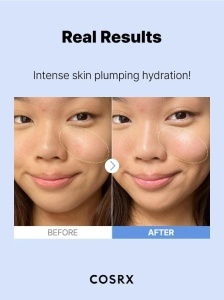 COSRX – The Hyaluronic Acid 3 Serum – Ser cu acid hialuronic 3% pentru hidratare profunda - Img 8