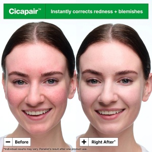 Dr.Jart+ - Cicapair™ Tiger Grass Color Correcting Treatment - Cremă corectoare pentru roșeață si uniformizarea nuanței tenului 50 ml - Img 2