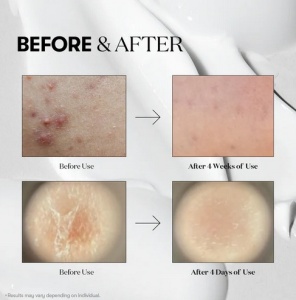 VT Cosmetics - Reedle Shot 50 - Ser booster facial cu microace, niacinamidă și propolis - Img 6