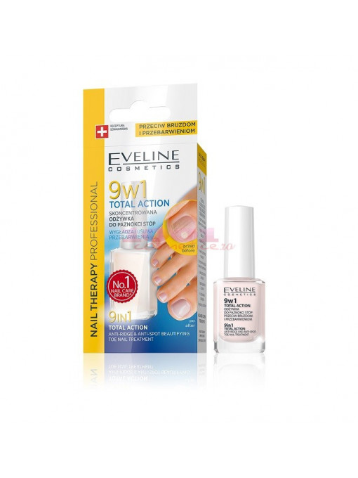 Ingrijirea unghiilor, eveline | Eveline cosmetics 9 in 1 total action tratament pentru unghiile picioarelor | 1001cosmetice.ro