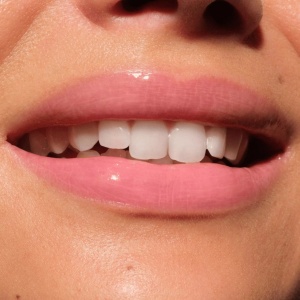 [Balsam buze butter drippin' lip gloss balm pink lemon squeezin’ 010 catrice, 10 ml - 1001cosmetice.ro] [7]