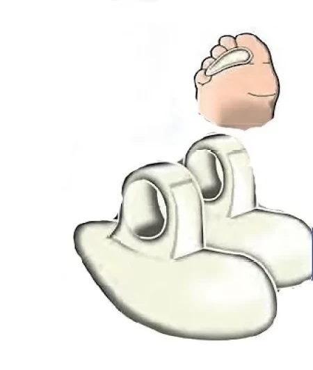 Fortuna FT-1265 jastuče - plantarni umetak za nožne prste S/M, 2 kom ( FT1265 )