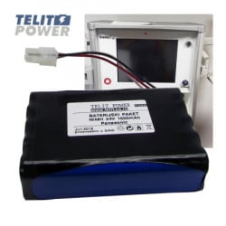 TelitPower baterija NiMH 24V 1600mAh za PHILIPS Dameca Siesta i TI ( P-1576 ) - Img 1