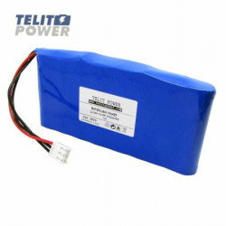 TelitPower baterija Li-Ion 14.4V 5700mAh LG za EKG monitor Comen CM1200A ( P-2216 ) - Img 1