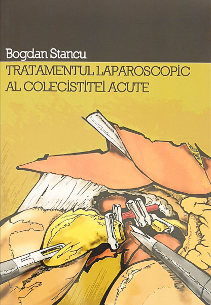 Tratamentul laparoscopic al colecistitei acute | Bogdan Stancu