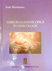 Chirurgia endoscopica in ginecologie | Ioan Munteanu