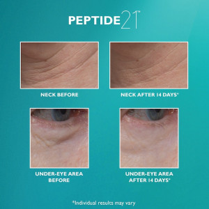 Ser antirid Peter Thomas Roth Peptide 21 Wrinkle Resist Serum, 30 Ml - Img 4