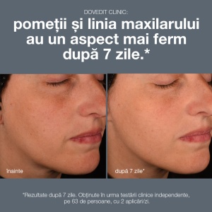 Ser Dermalogica Pro-Collagen Banking, Plumping, Pentru Fermitate