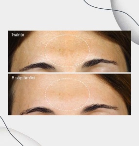 Ser Pentru Fata Dermalogica, PowerBright, Anti-Pete Intunecate