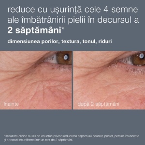 Ser antirid cu retinol Dermalogica Dynamic Skin, pentru fata, 30 ml