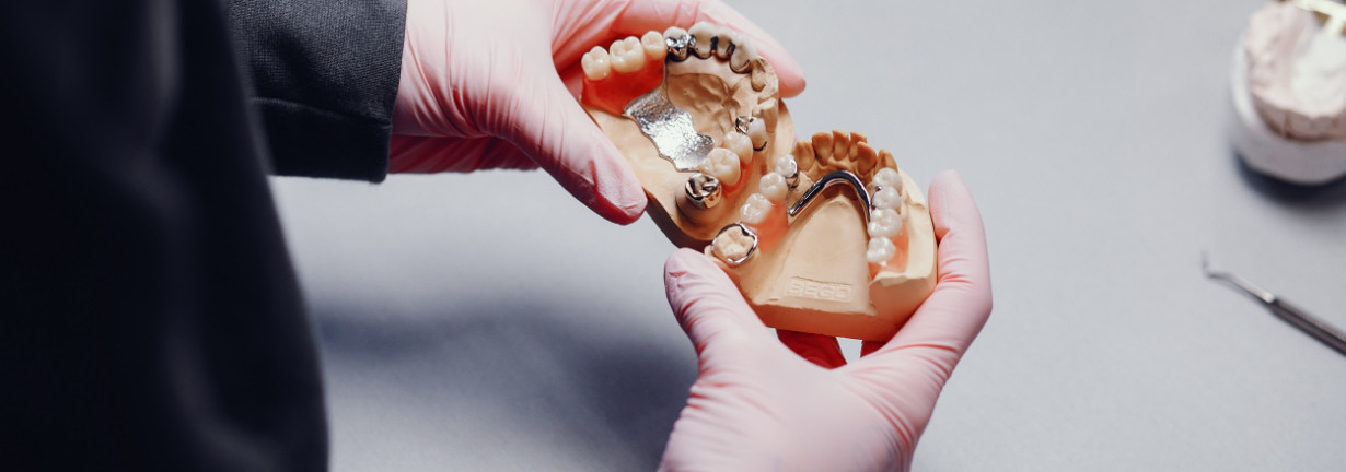Sunt implanturile dentare dureroase?