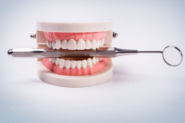 Înlocuiți-vă dinții în etape cu ajutorul implanturilor dentare