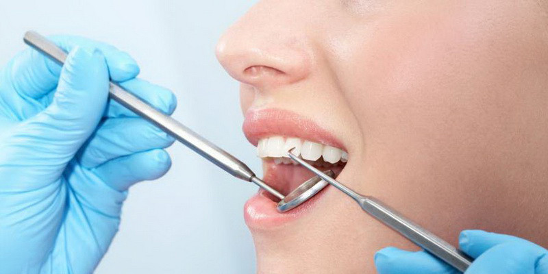 Diferența dintre curățarea parodontală și profilaxia dentară