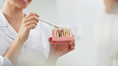 Eșecul implantului dentar - Cauze si metode de prevenție