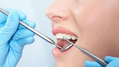 Diferența dintre curățarea parodontală și profilaxia dentară