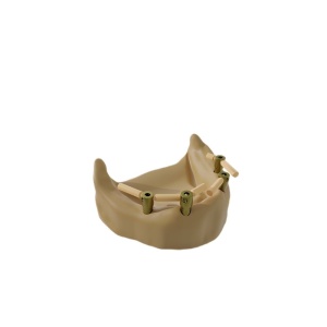 Pini Scanbody C | 13 mm [5 buc] - Img 3