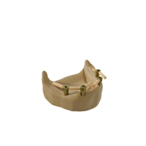 Pini Scanbody B | 9 mm [5 buc] - Img 3