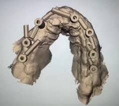 Scanbody Reference | Multiunit - Img 5