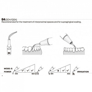Ansa detartraj G4 - Img 2