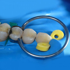 Aplicator matrice set 1399 - Img 3