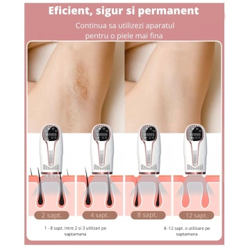 Resigilat - Epilator IPL WowStep®, epilare definitiva fara durere, 999.999 impulsuri, Tehnologie IPL, 5 trepte de intensitate, pentru barbati si femei, Senzor Piele, fata, corp, axila si inghinal - Img 10