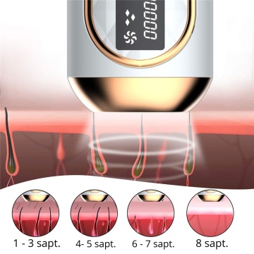 Resigilat - Epilator IPL WowStep®, epilare definitiva fara durere, 999.999 impulsuri, Tehnologie IPL, 5 trepte de intensitate, pentru barbati si femei, Senzor Piele, fata, corp, axila si inghinal, Alb - Img 4