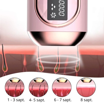 Resigilat - Epilator IPL WowStep®, epilare definitiva fara durere, 999.999 impulsuri, Tehnologie IPL, 5 trepte de intensitate, pentru barbati si femei, Senzor Piele, fata, corp, axila si inghinal, Roz - Img 6