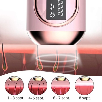 Epilator IPL WowStep®, epilare definitiva fara durere, 999.999 impulsuri, Tehnologie IPL, 5 trepte de intensitate, pentru barbati si femei, Senzor Piele, fata, corp, axila si inghinal, Roz - Img 6
