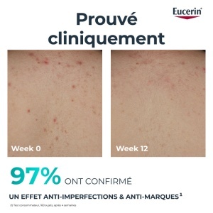 Eucerin Dermopure Clinical Cremă Corp Triple Action 200ml - Img 2