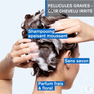 Uriage DS Hair Șampon Tratament Kerato-Reductor 150ml - Img 4