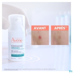 Avène Cleanance Comedomed+ Tratament Intensiv Anti-Imperfecțiuni 30ml - Img 3