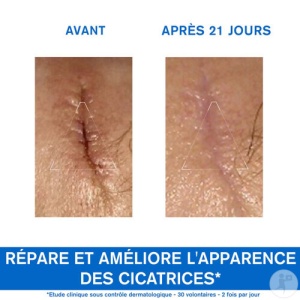 Uriage Bariéderm Cică-Cremă Reparatoare Cupru Și Zinc Piele Fragilă Și Iritată Tub 40ml - Img 4