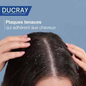 Ducray Kelual Squanorm Șampon Tratament Reglator Anti-Mătreață Pentru Scalp Gras 200ml - Img 5