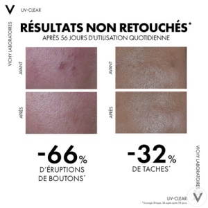 Vichy Capital Soleil UV‑Clear Fluid Anti‑Imperfecțiuni SPF50+ Flacon Cu Pompiță 40ml - Img 3