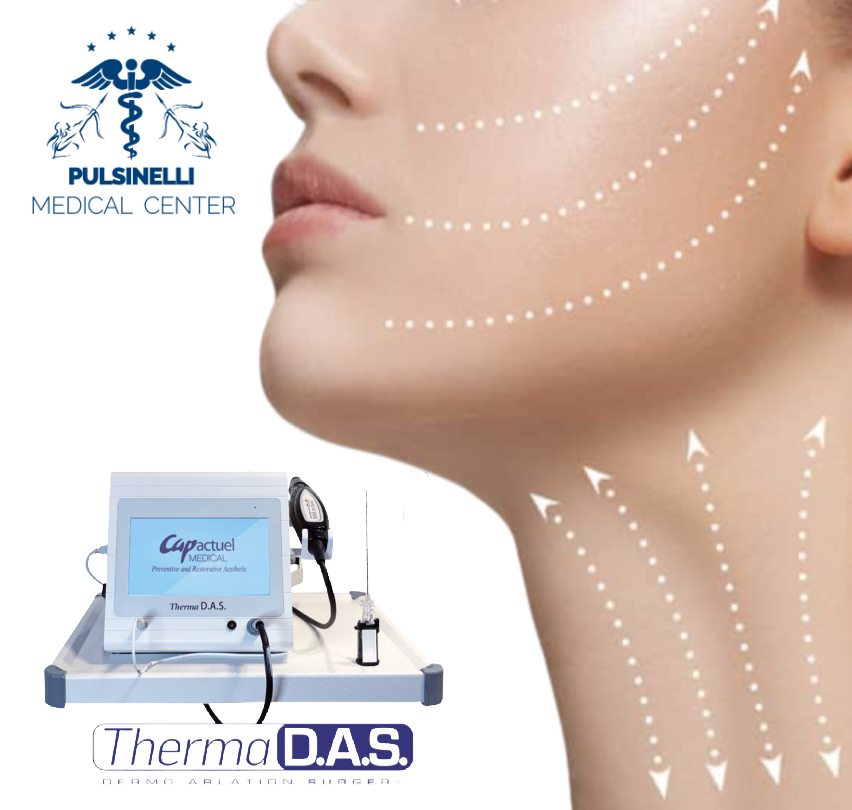 LIFTING NON CHIRURGICO
