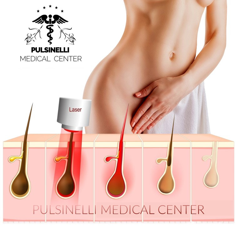 SPECIALE LASER ALESSANDRITE SCADE IL 30/09/23