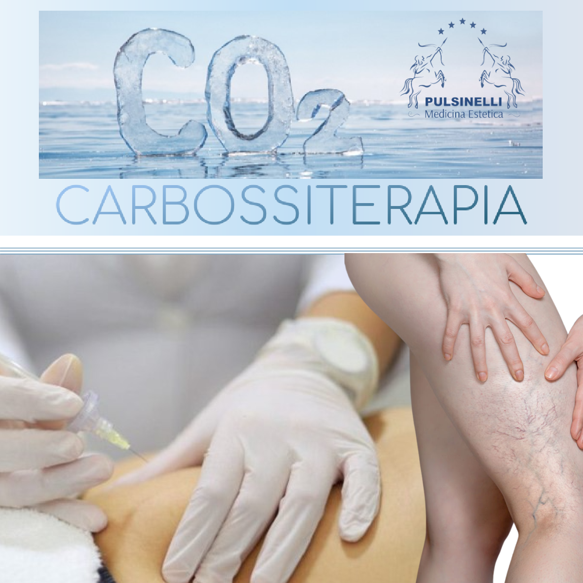 CARBOSSITERAPIA